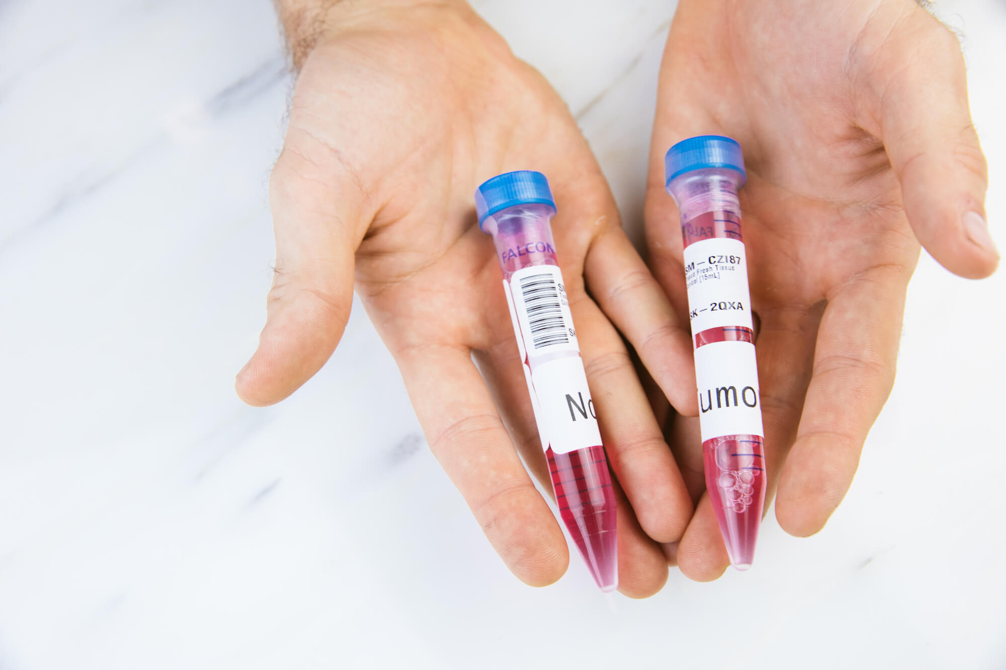 Two hands hold vials with tissue samples inside