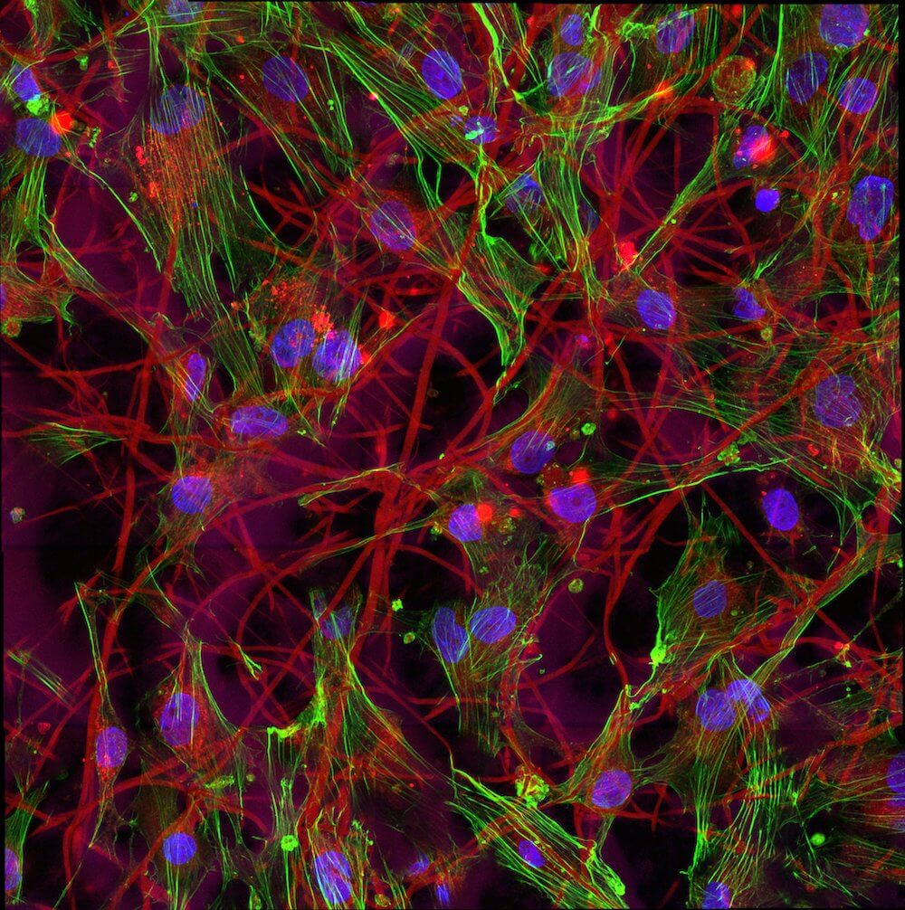 Seed Networks for the Human Cell Atlas photo of human tendon cell scaffolds (CZI Single-Cell Biology).