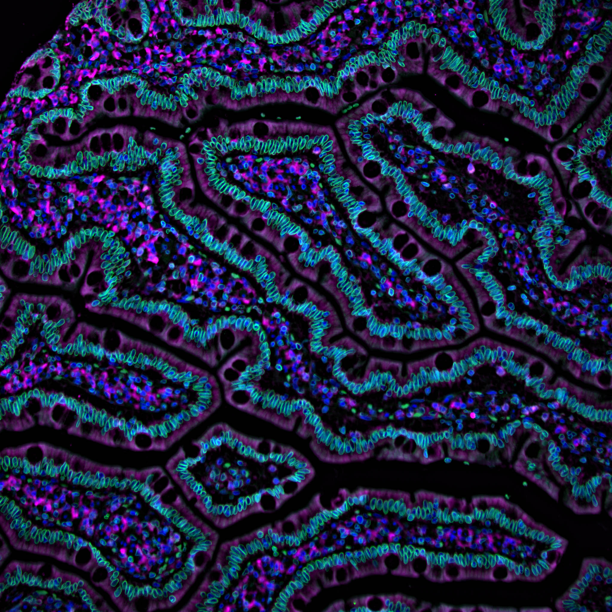 An immunofluorescence image of the first part of the small intestine, called the duodenum (CZI Single-Cell Biology).