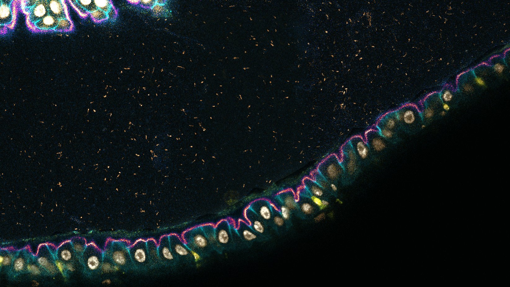 Immune cells and microbes interacting across the fragile, one-cell thick gut lining of a fruit fly (CZI Single-Cell Biology).