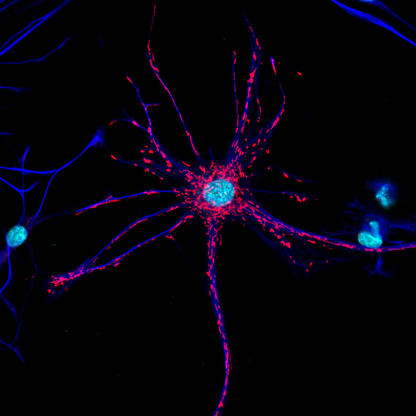 A cultured rat astrocyte with its mitochondria (CZI Neurodegeneration Challenge Network, NDCN).