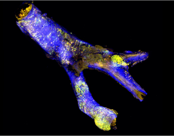 The carotid artery of a mouse with artherosclerosis (CZI Imaging).
