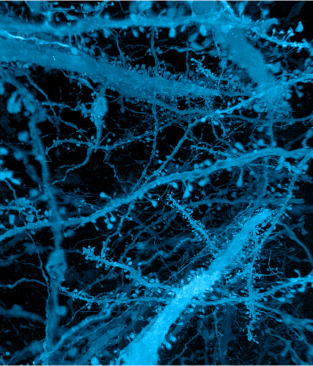 A forest of nerve cells (axons, dendrites, and dendritic spines of neurons) in the brain (CZI Imaging).