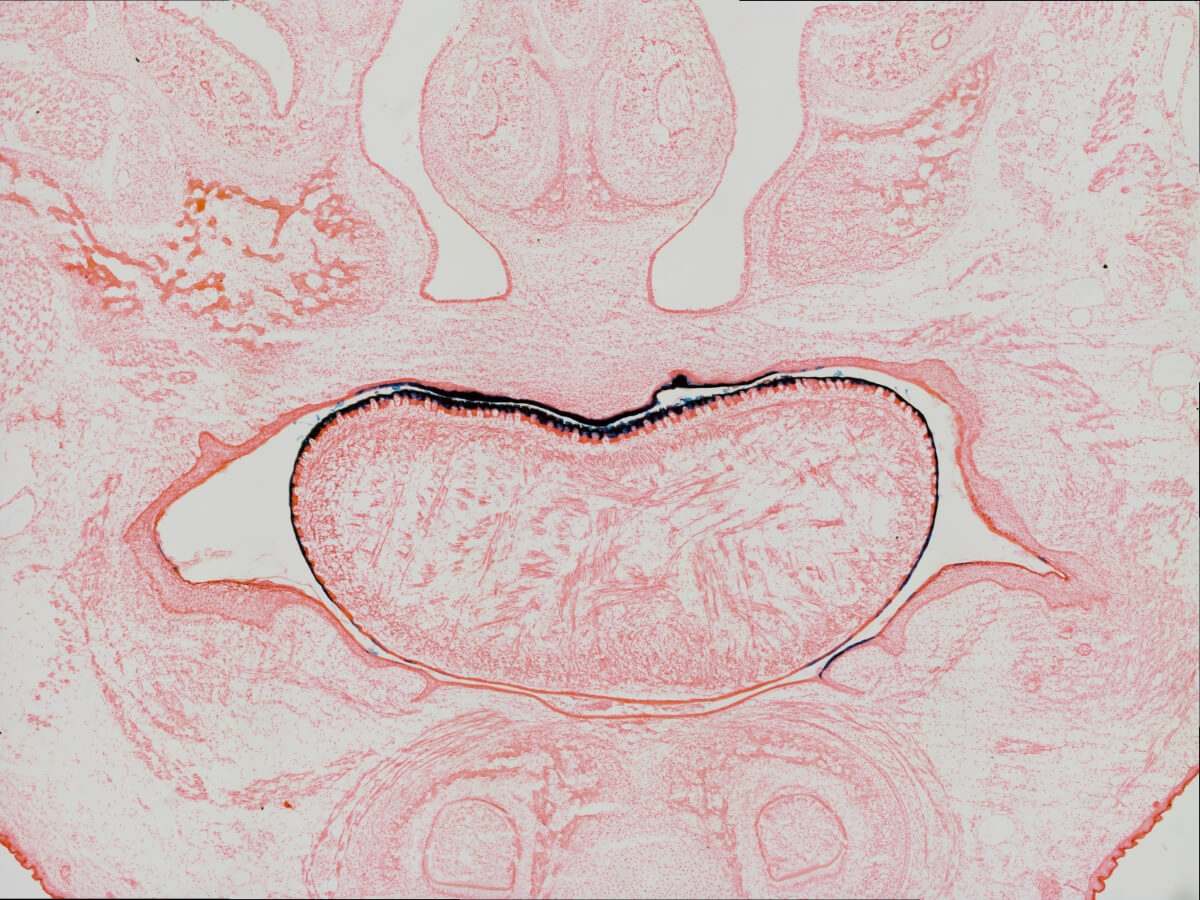 A pinkish image of a kidney bean-shaped structure.