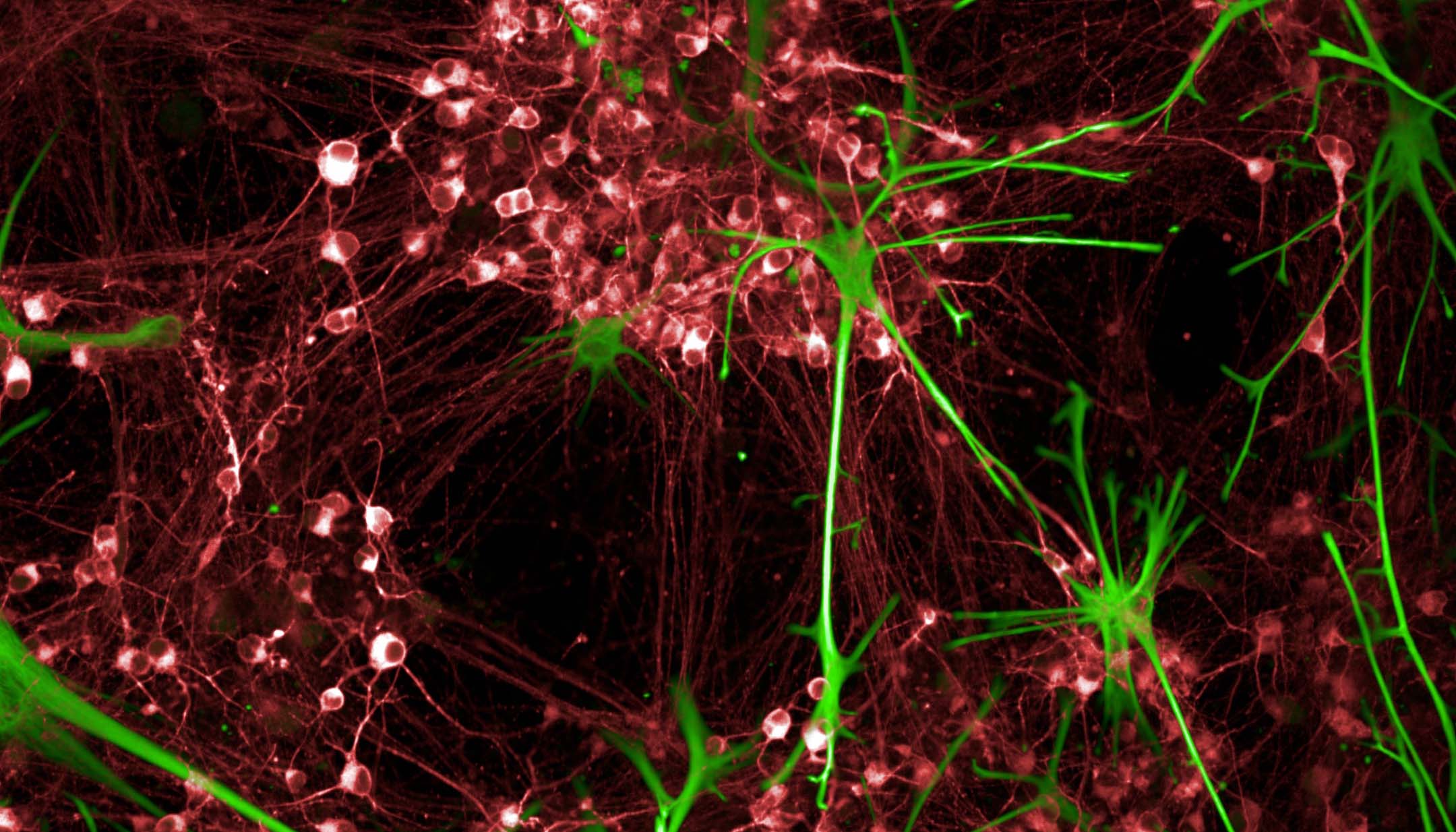 Image of red neurons against a dark background, lines of green astrocytes overlay across the neurons 