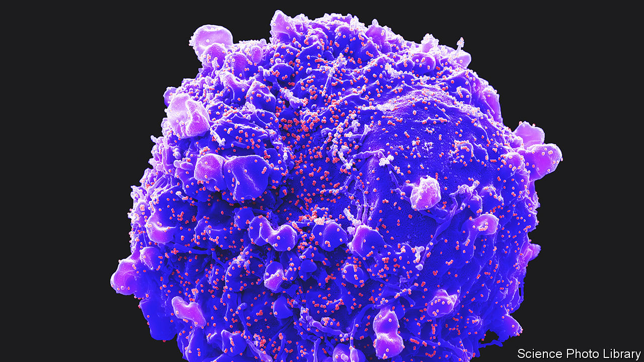 Hundreds of small orange virus particles on the surface of a large, round, purple kidney cell.