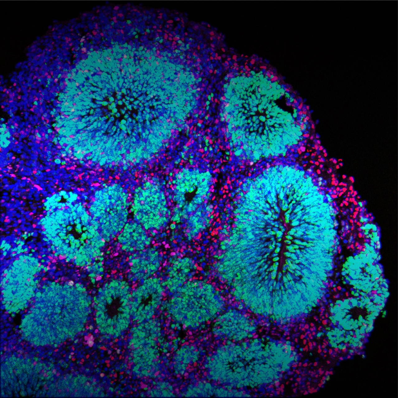 Fluorescent purple and turquoise dots make up the shape of the organoid against a black background.