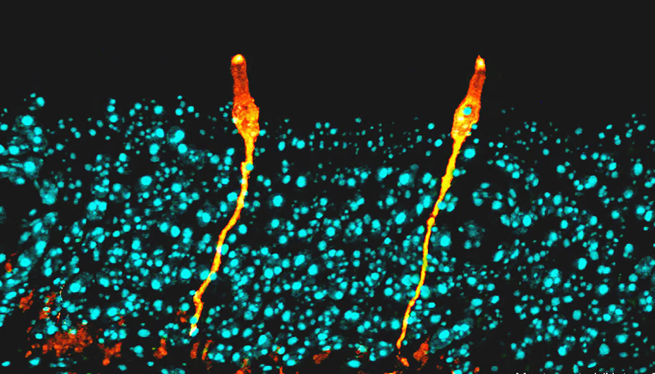 Pulmonary ionocytes (orange) extend through neighboring epithelial cells in the upper respiratory tract of the mouse, to the surface of the epithelial lining; cell nuclei in cyan.