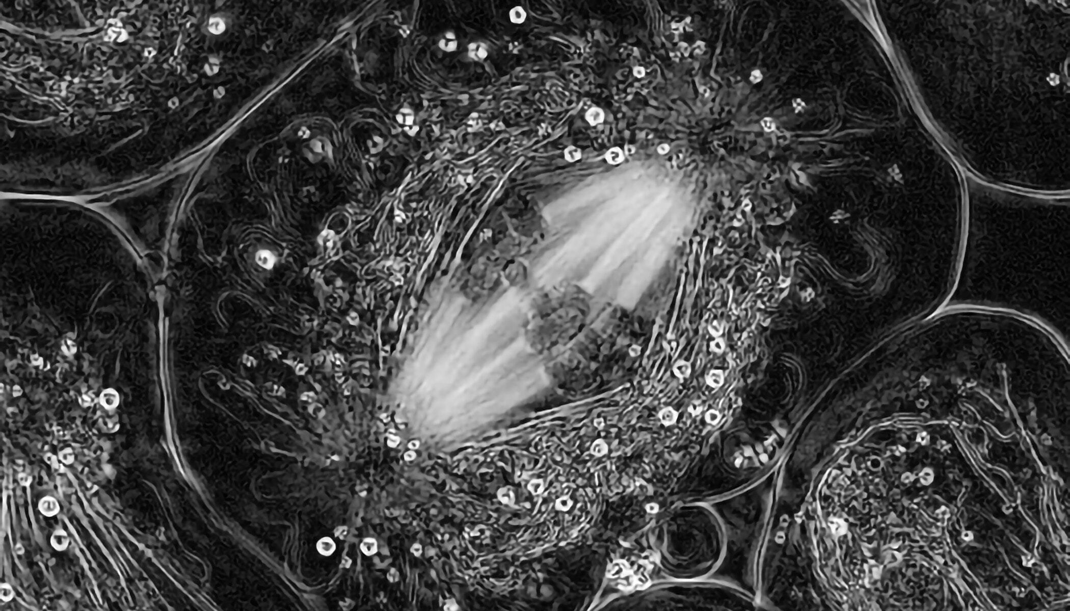 Black and white image of a cell with four bright strands being separated from either end of the cell as it divides.