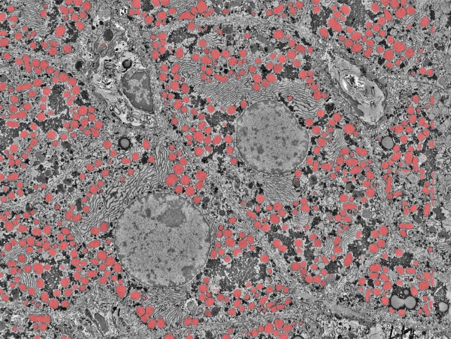 Many tiny red circles clustered together by grey lines, swirls and larger circles.