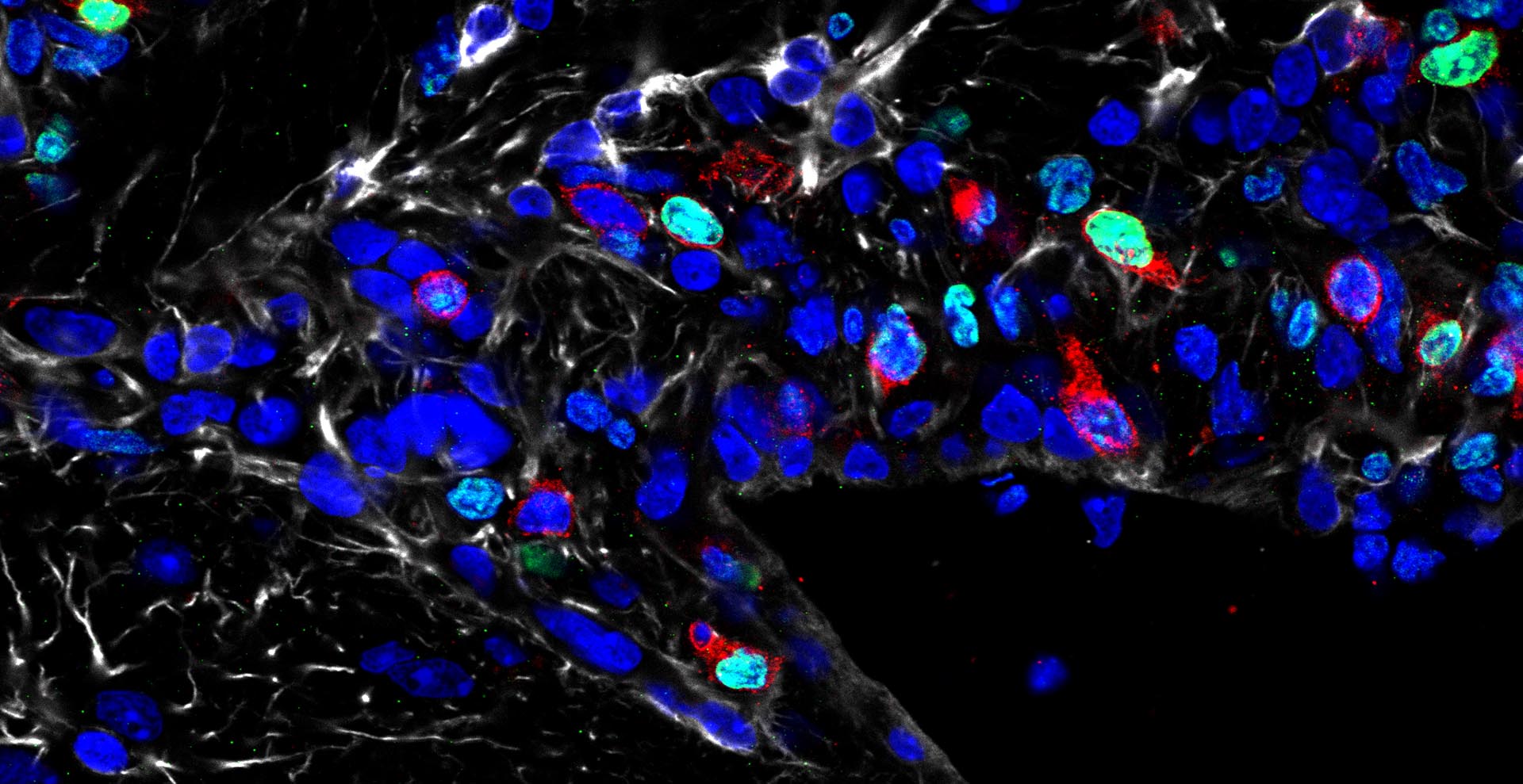  A black image with bold, blue and teal spots. Pixels of red surround some of the spots.