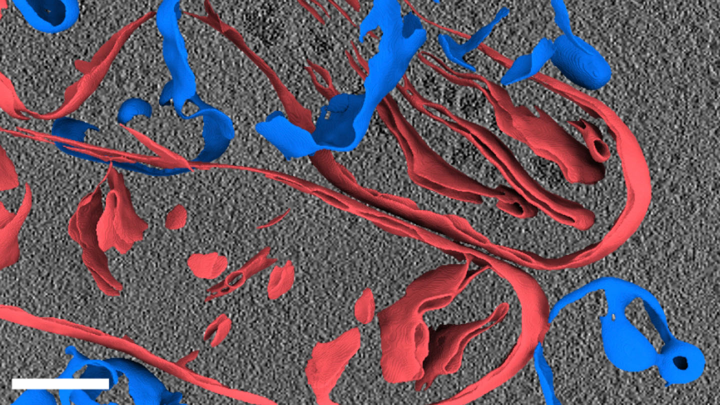 A high-resolution 3D visualization of cellular structures, with red and blue components representing different cellular elements, set against a textured gray background, showcasing intricate biological details.